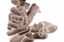 Koliformní bakterie
